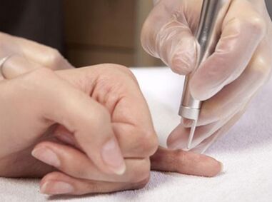 Conduct laser therapy